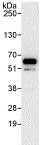 Immunoprecipitation - Anti-RAB antibody (AB86349)