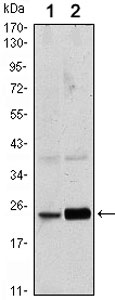 Western blot - Anti-RAB10 antibody [4E2] (AB104859), expandable thumbnail