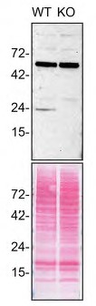 Western blot - Anti-RAB10 antibody [EPR13242] (AB181367), expandable thumbnail