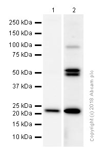 Western blot - Anti-RAB10 antibody [EPR13242] (AB181367), expandable thumbnail