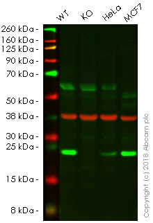 Western blot - Anti-RAB10 antibody [EPR13242] - BSA and Azide free (AB224886)