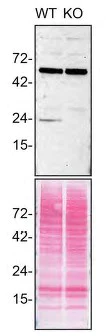Western blot - Anti-RAB10 antibody [EPR13242] - BSA and Azide free (AB224886)