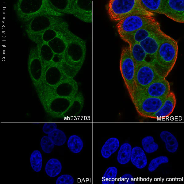Immunocytochemistry/ Immunofluorescence - Anti-RAB10 antibody [MJF-R23] (AB237703)