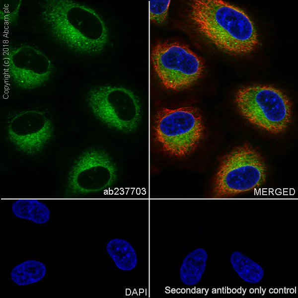 Anti-RAB10 antibody [MJF-R23] (ab237703) | Abcam