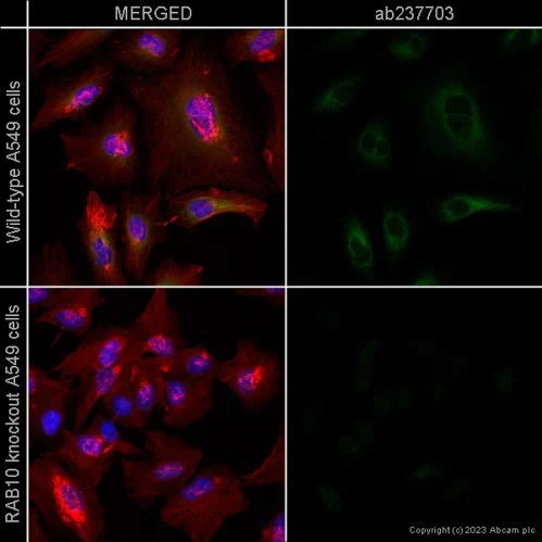 Immunocytochemistry/ Immunofluorescence - Anti-RAB10 antibody [MJF-R23] (AB237703)