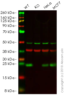 Western blot - Anti-RAB10 antibody [MJF-R23] (AB237703)