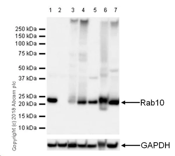 Western blot - Anti-RAB10 antibody [MJF-R23] (AB237703)