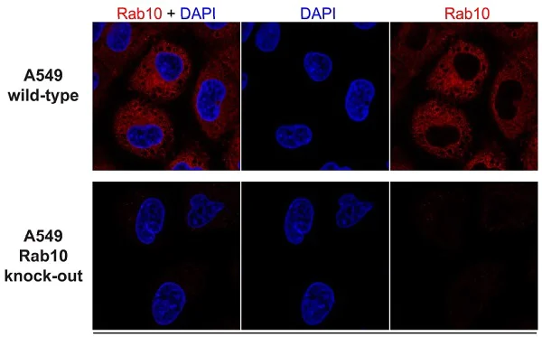Immunocytochemistry/ Immunofluorescence - Anti-RAB10 antibody [MJF-R23] - BSA and Azide free (AB238655)
