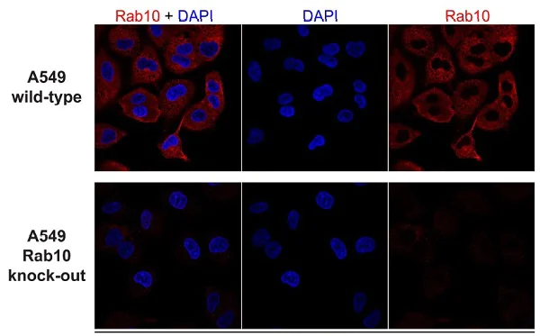 Immunocytochemistry/ Immunofluorescence - Anti-RAB10 antibody [MJF-R23] - BSA and Azide free (AB238655)