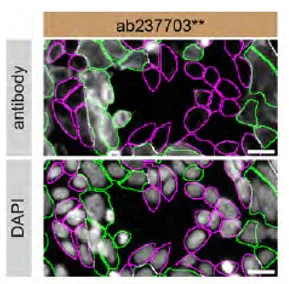 Immunocytochemistry/ Immunofluorescence - Anti-RAB10 antibody [MJF-R23] - BSA and Azide free (AB238655)