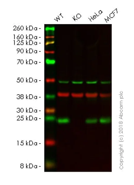 Western blot - Anti-RAB10 antibody [MJF-R23] - BSA and Azide free (AB238655)