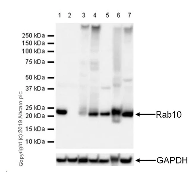 Western blot - Anti-RAB10 antibody [MJF-R23] - BSA and Azide free (AB238655)