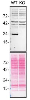 Western blot - Anti-RAB10 antibody [MJF-R23] - BSA and Azide free (AB238655)