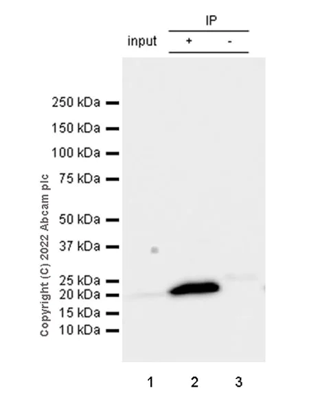 Immunoprecipitation - Anti-RAB10 antibody [MJF-R23] - Mouse IgG2a (Chimeric) (AB307296)
