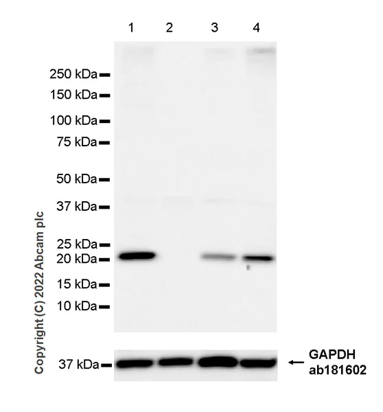 Western blot - Anti-RAB10 antibody [MJF-R23] - Mouse IgG2a (Chimeric) - BSA and Azide free (AB307297)