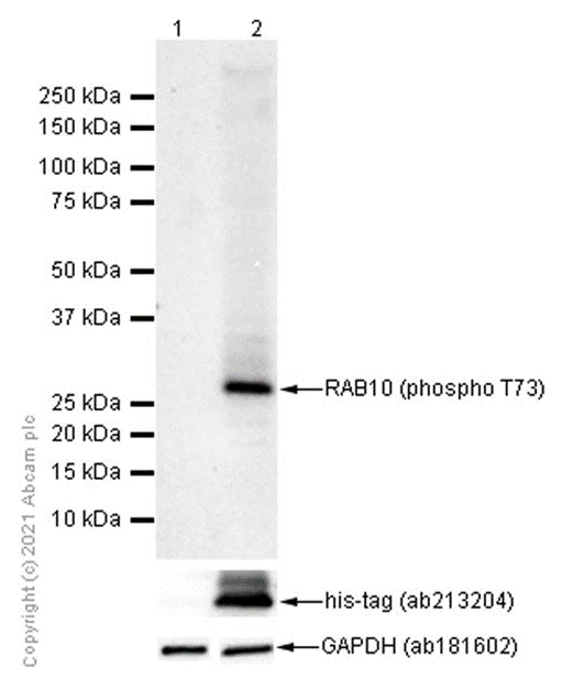 Western blot - Anti-RAB10 (phospho T73) antibody [MJF-R21] (AB230261)