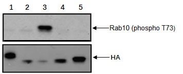 Western blot - Anti-RAB10 (phospho T73) antibody [MJF-R21] (AB230261), expandable thumbnail