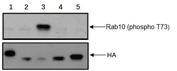 Western blot - Anti-RAB10 (phospho T73) antibody [MJF-R21] (AB230261)
