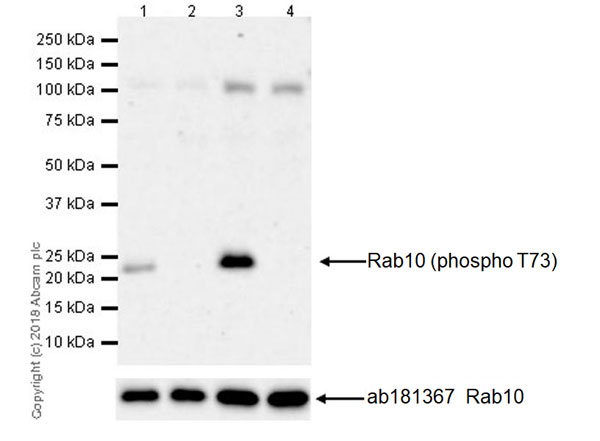 Western blot - Anti-RAB10 (phospho T73) antibody [MJF-R21] (AB230261), expandable thumbnail