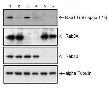 Western blot - Anti-RAB10 (phospho T73) antibody [MJF-R21] (AB230261), expandable thumbnail