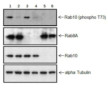 Anti-RAB10 (phospho T73) antibody [MJF-R21] (ab230261) | Abcam