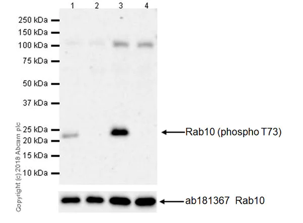 Western blot - Anti-RAB10 (phospho T73) antibody [MJF-R21] - BSA and Azide free (AB231707)