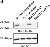 Western blot - Anti-Rab11A antibody (AB65200)