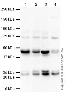 Western blot - Anti-Rab11A antibody (AB65200)