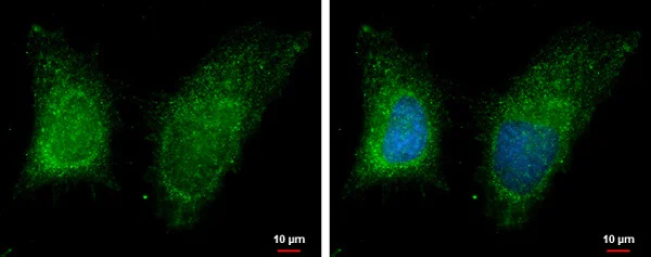 Immunocytochemistry/ Immunofluorescence - Anti-RAB11B antibody (AB228954)