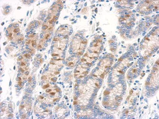 Immunohistochemistry (Formalin/PFA-fixed paraffin-embedded sections) - Anti-RAB11B antibody (AB228954)