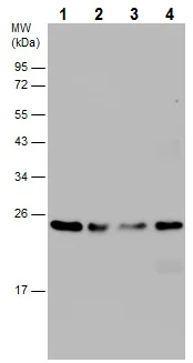 Western blot - Anti-RAB11B antibody (AB228954)