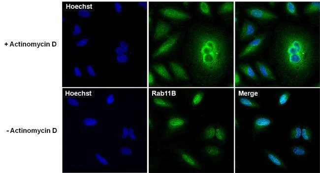 Immunocytochemistry - Anti-RAB11B antibody (AB3612), expandable thumbnail
