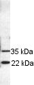 Western blot - Anti-RAB11B antibody (AB3612), expandable thumbnail