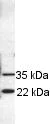 Western blot - Anti-RAB11B antibody (AB3612)