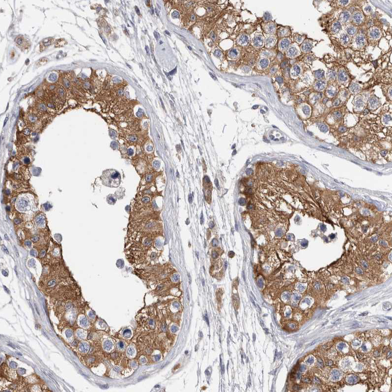 Immunohistochemistry (Formalin/PFA-fixed paraffin-embedded sections) - Anti-RAB11FIP1 antibody (AB251765), expandable thumbnail