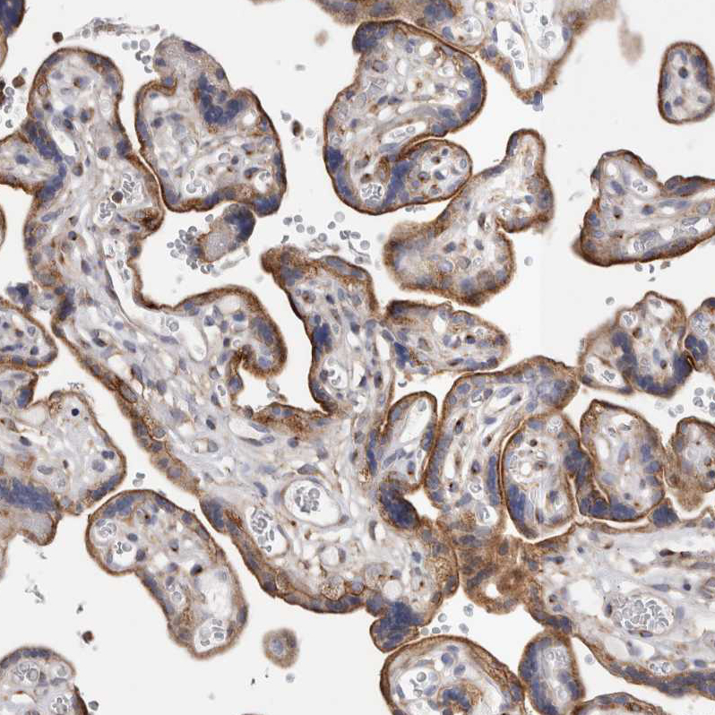 Immunohistochemistry (Formalin/PFA-fixed paraffin-embedded sections) - Anti-RAB11FIP1 antibody (AB251765), expandable thumbnail