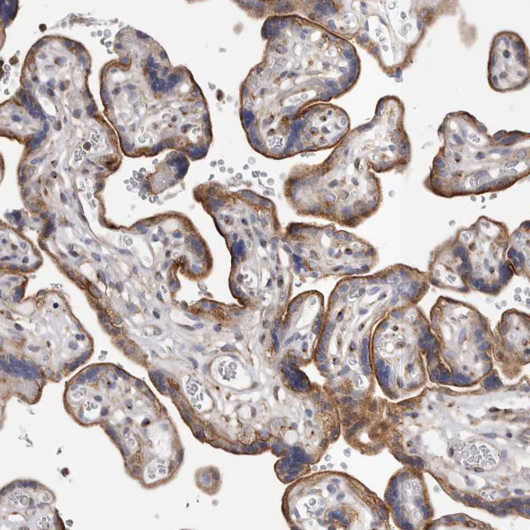 Immunohistochemistry (Formalin/PFA-fixed paraffin-embedded sections) - Anti-RAB11FIP1 antibody (AB251765)