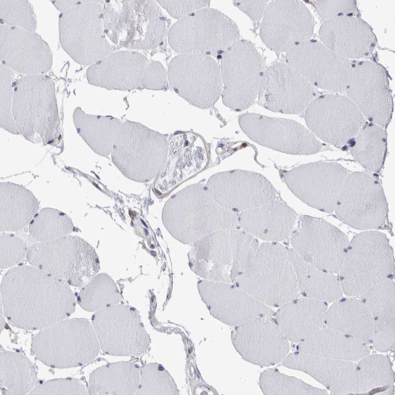 Immunohistochemistry (Formalin/PFA-fixed paraffin-embedded sections) - Anti-RAB11FIP1 antibody (AB251765), expandable thumbnail