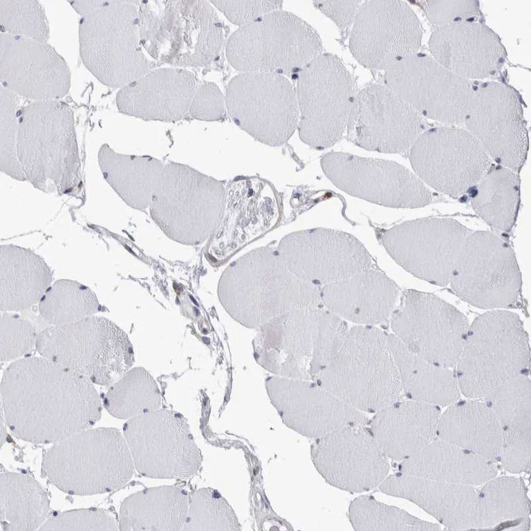 Immunohistochemistry (Formalin/PFA-fixed paraffin-embedded sections) - Anti-RAB11FIP1 antibody (AB251765)