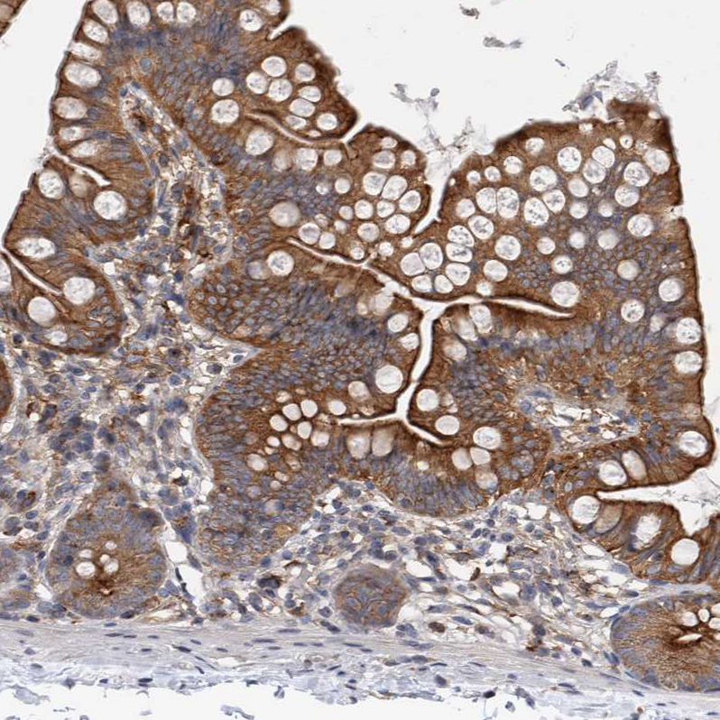 Immunohistochemistry (Formalin/PFA-fixed paraffin-embedded sections) - Anti-RAB11FIP1 antibody (AB251765), expandable thumbnail
