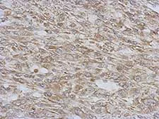 Immunohistochemistry (Formalin/PFA-fixed paraffin-embedded sections) - Anti-RAB11FIP5 antibody (AB153843)