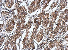 Immunohistochemistry (Formalin/PFA-fixed paraffin-embedded sections) - Anti-RAB11FIP5 antibody (AB153843)