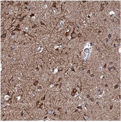 Immunohistochemistry (Formalin/PFA-fixed paraffin-embedded sections) - Anti-RAB12 antibody (AB122666)