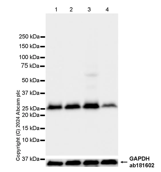 Western blot - Anti-RAB12 antibody [EPR28814-81] (AB316770)