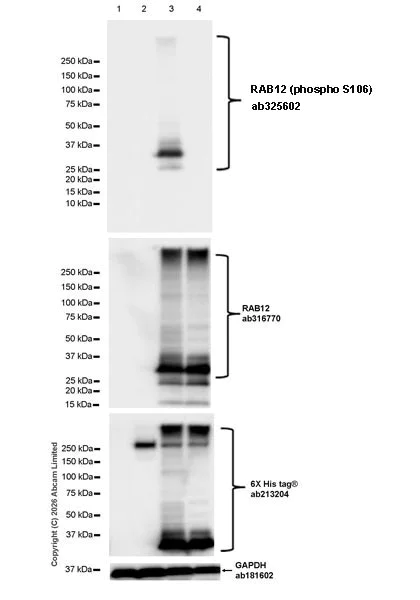 Western blot - Anti-RAB12 antibody [EPR28814-81] (AB316770)