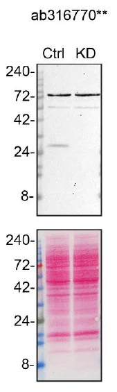 RAB12抗体[EPR28814-81] (ab316770)| Abcam中文官网