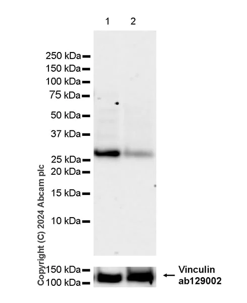 Western blot - Anti-RAB12 antibody [EPR28814-81] - BSA and Azide free (AB316771)