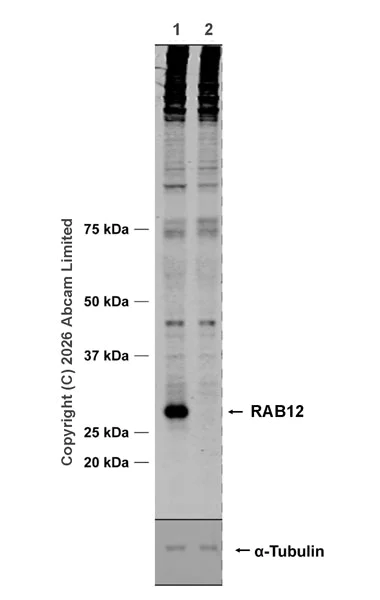 Western blot - Anti-RAB12 antibody [MJF-D28814-65R] (AB325799)