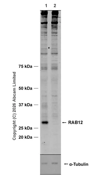 Western blot - Anti-RAB12 antibody [MJF-D28814-65R] (AB325799)
