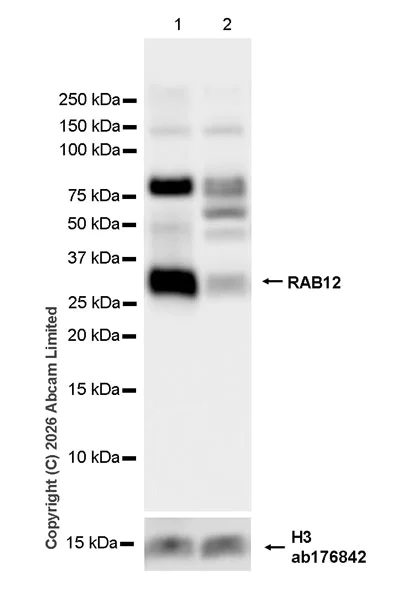 Western blot - Anti-RAB12 antibody [MJF-D28814-65R] (AB325799)